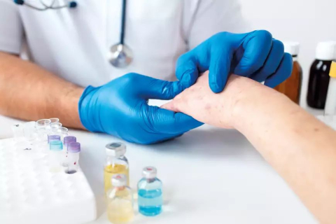 Atópiás dermatitis